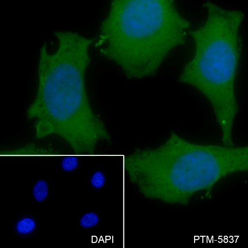 Anti-UGDH Mouse mAb