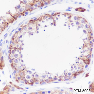 Anti-Inhibin alpha Rabbit mAb