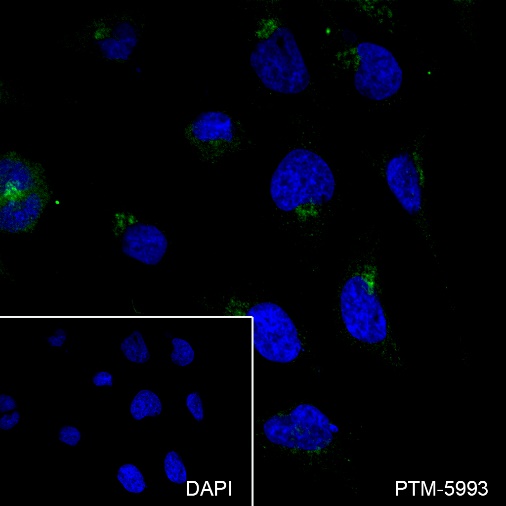 Anti-Inhibin alpha Rabbit mAb