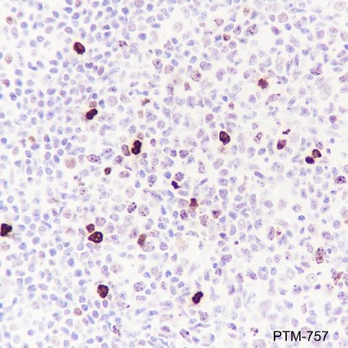 Anti-Phospho-Histone H3 (Ser10) Mouse mAb