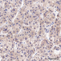 Anti-FABP1 Rabbit mAb