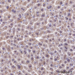 Anti-FABP1 Rabbit mAb