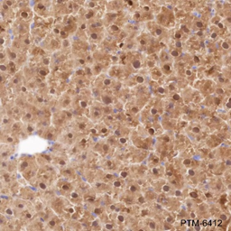 Anti-FABP1 Rabbit mAb