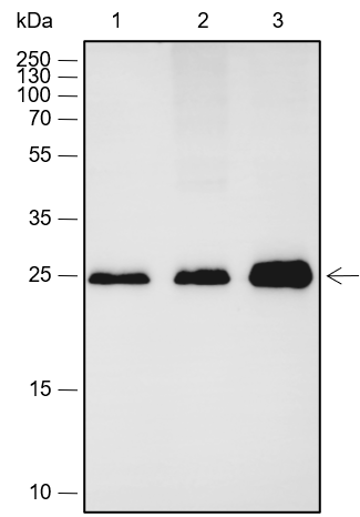 Anti-Calbindin Rabbit mAb