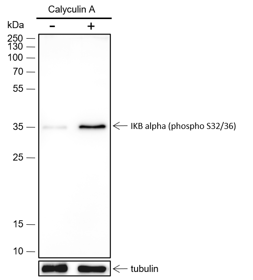 Anti-Phospho-IkB alpha (Ser32/36) Rabbit mAb