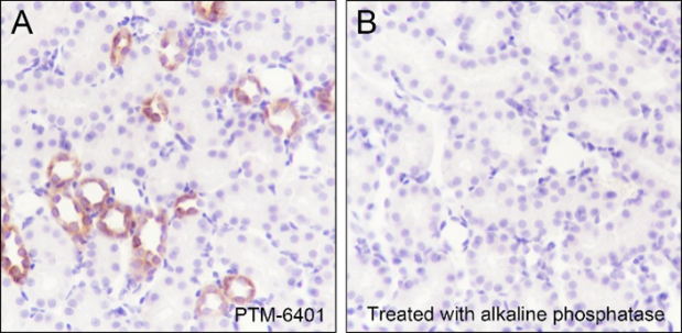 Anti-Phospho-IkB alpha (Ser32/36) Rabbit mAb
