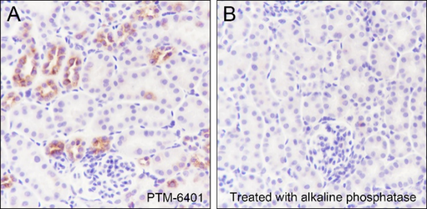 Anti-Phospho-IkB alpha (Ser32/36) Rabbit mAb