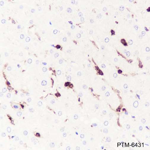 Anti-LILRB1 Rabbit mAb
