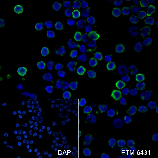 Anti-LILRB1 Rabbit mAb