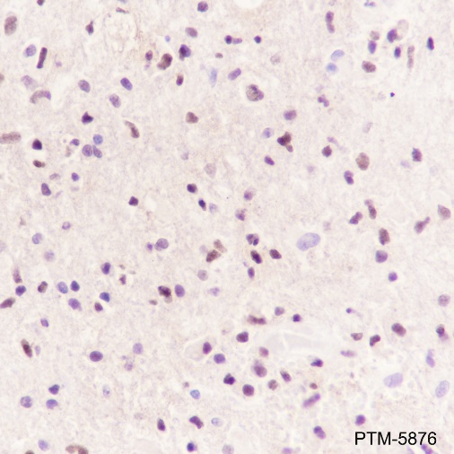 Anti-SOX11 Rabbit mAb