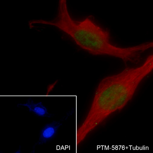 Anti-SOX11 Rabbit mAb