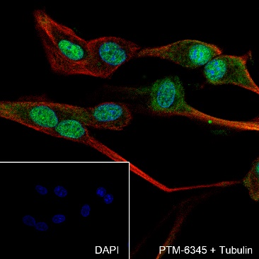 Anti-alpha-Synuclein Rabbit mAb