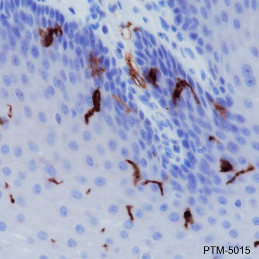 Anti-CD1a Rabbit mAb