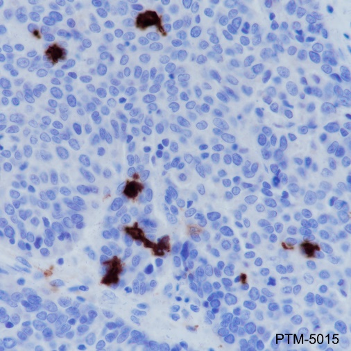 Anti-CD1a Rabbit mAb