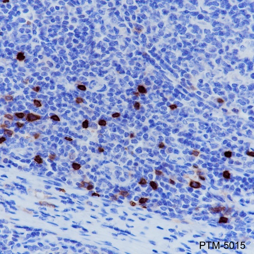 Anti-CD1a Rabbit mAb