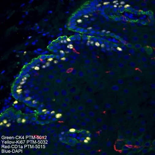 Anti-CD1a Rabbit mAb
