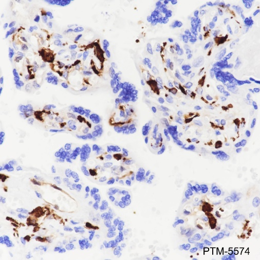 Anti-Factor XIIIa Rabbit mAb