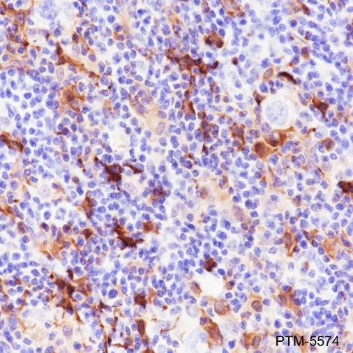 Anti-Factor XIIIa Rabbit mAb