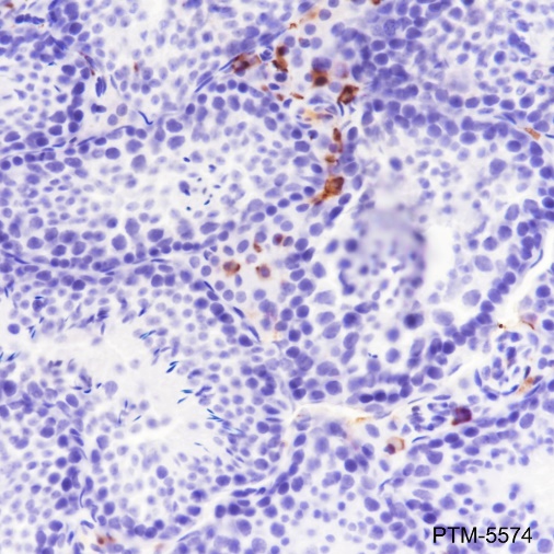 Anti-Factor XIIIa Rabbit mAb