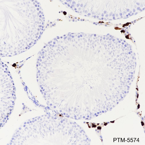 Anti-Factor XIIIa Rabbit mAb