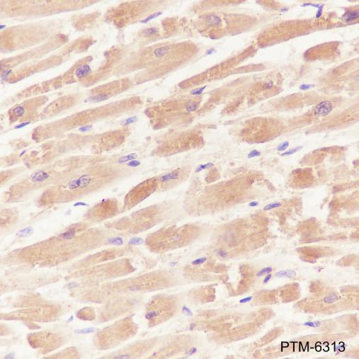 Anti-FABP3 Mouse mAb