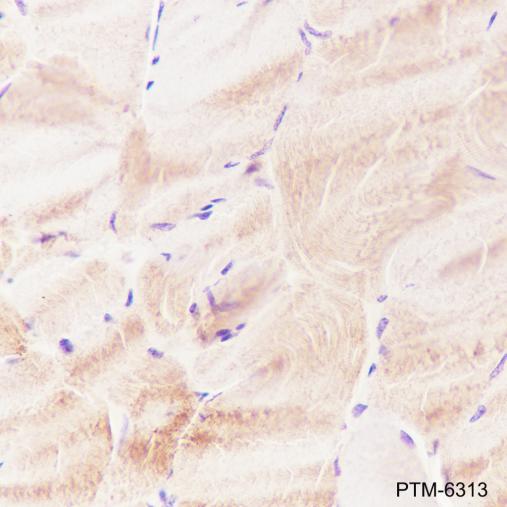 Anti-FABP3 Mouse mAb