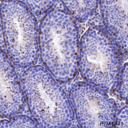 Anti-p27 Kip1 Rabbit mAb