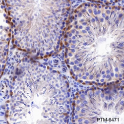 Anti-p27 Kip1 Rabbit mAb