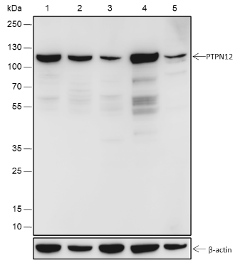 Anti-PTPN12 Rabbit mAb