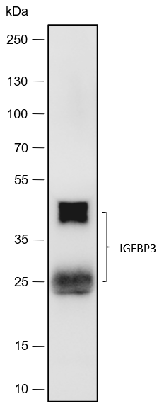 Anti-IGFBP3 Rabbit mAb