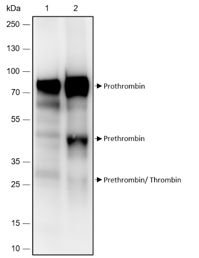 Anti-Prothrombin Rabbit mAb