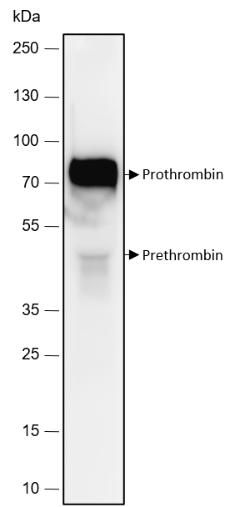 Anti-Prothrombin Rabbit mAb