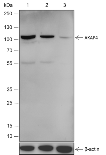 Anti-AKAP4 Rabbit mAb