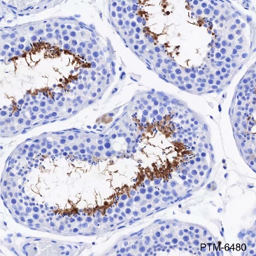 Anti-AKAP4 Rabbit mAb