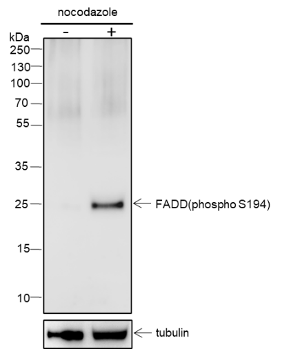 Anti-Phospho-FADD (Ser194) Rabbit mAb