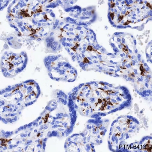 Anti-CD163 Rabbit mAb