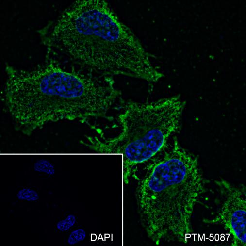 Anti-PKM2 Mouse mAb