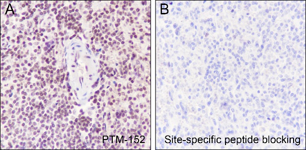Anti-Acetyl-Histone H2B (Lys5) Mouse mAb