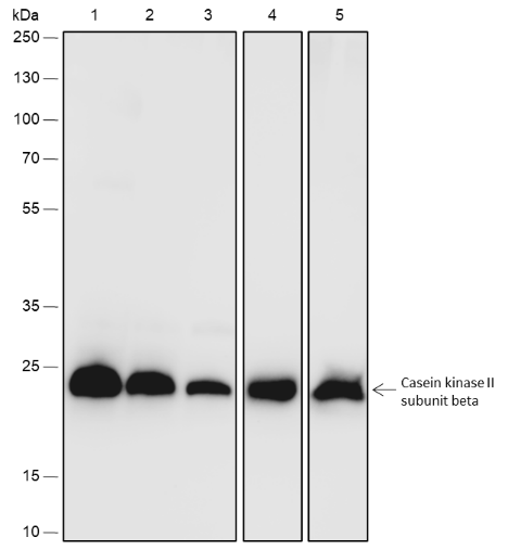 Anti-Casein Kinase 2 beta Rabbit mAb