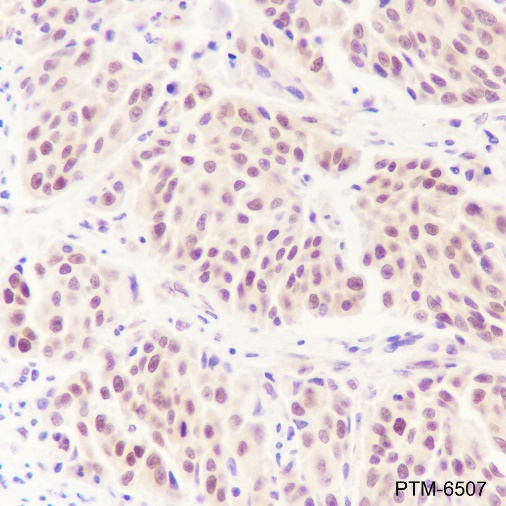 Anti-Casein Kinase 2 beta Rabbit mAb