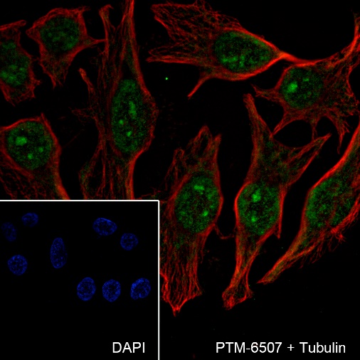 Anti-Casein Kinase 2 beta Rabbit mAb