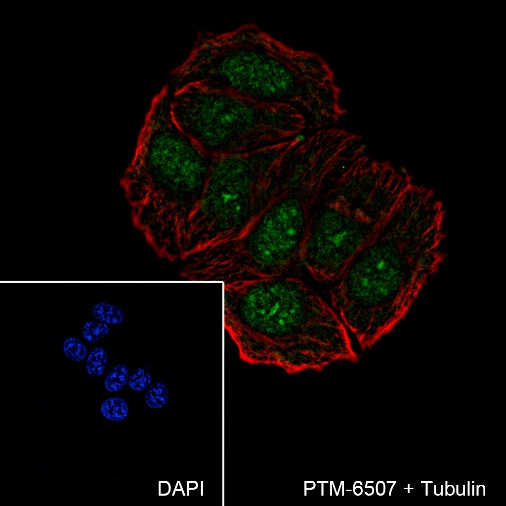 Anti-Casein Kinase 2 beta Rabbit mAb