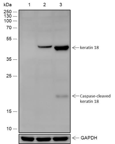 Anti-Keratin 18 Rabbit mAb