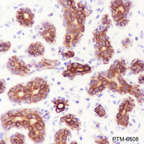 Anti-Keratin 18 Rabbit mAb