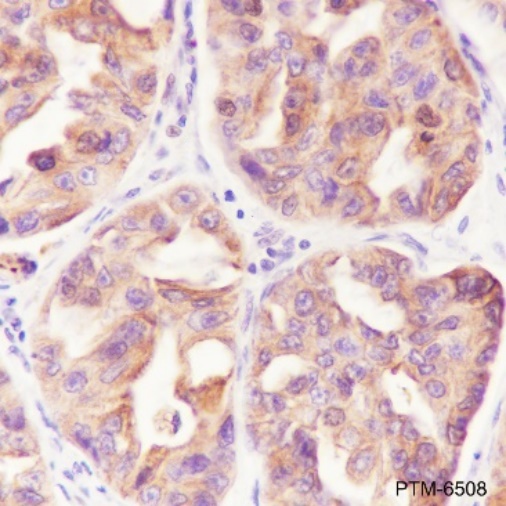 Anti-Keratin 18 Rabbit mAb