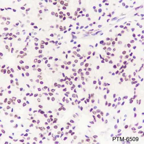 Anti-TDP43 Rabbit mAb