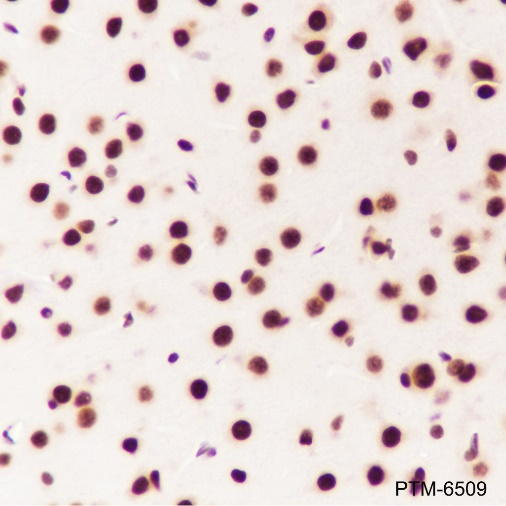 Anti-TDP43 Rabbit mAb