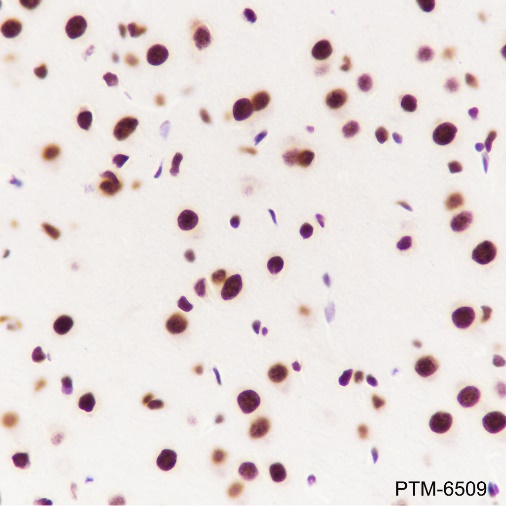 Anti-TDP43 Rabbit mAb