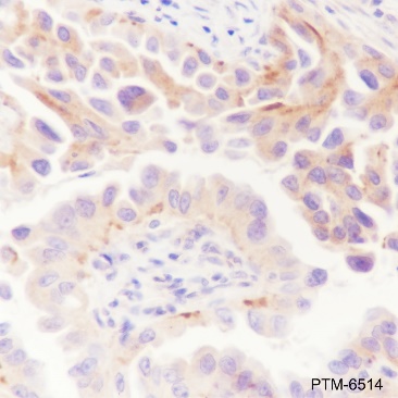 Anti-ATG9A Rabbit mAb