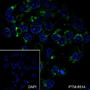 Anti-ATG9A Rabbit mAb